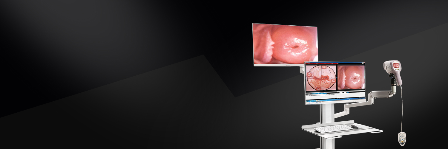 HD Camera